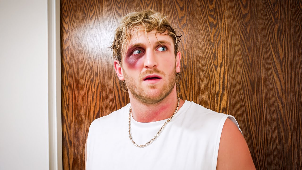 I Got Punched In The Face **Not Clickbait**