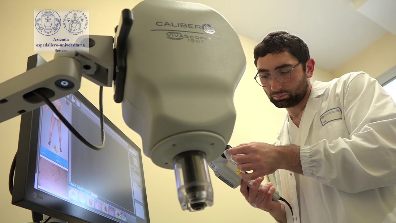Dermatologia, all'Aou Senese arriva il primo microscopio laser confocale della Toscana
