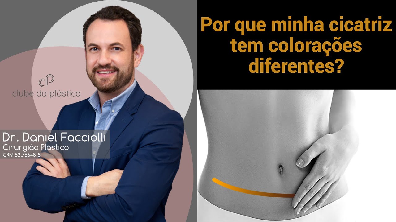 Clube da Plástica: Por que minha cicatriz tem colorações diferentes?