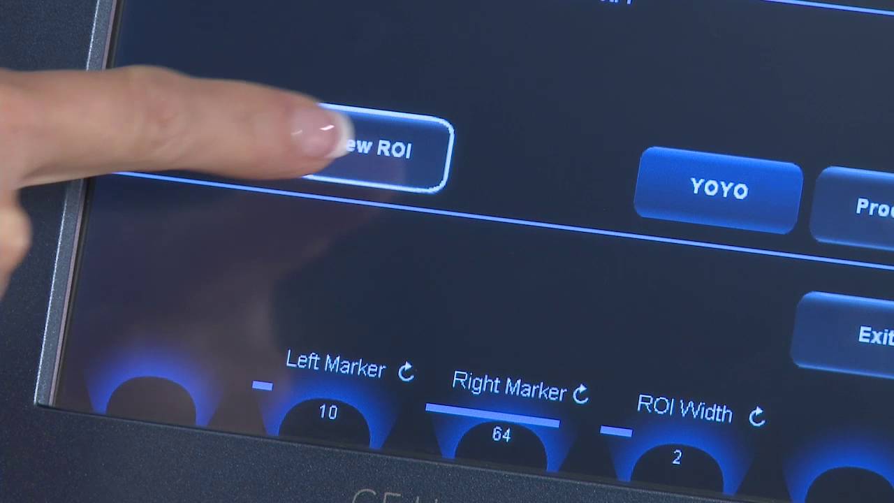 Cómo realizar un AFI con Vivid T8