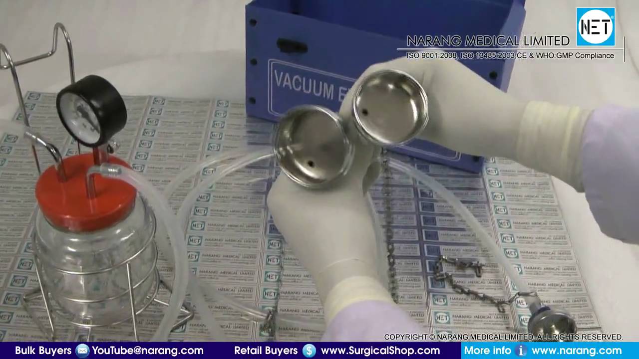 Vacuum Extractor Set, Manual Operated with 3 SS Cups. Item Code: VE026