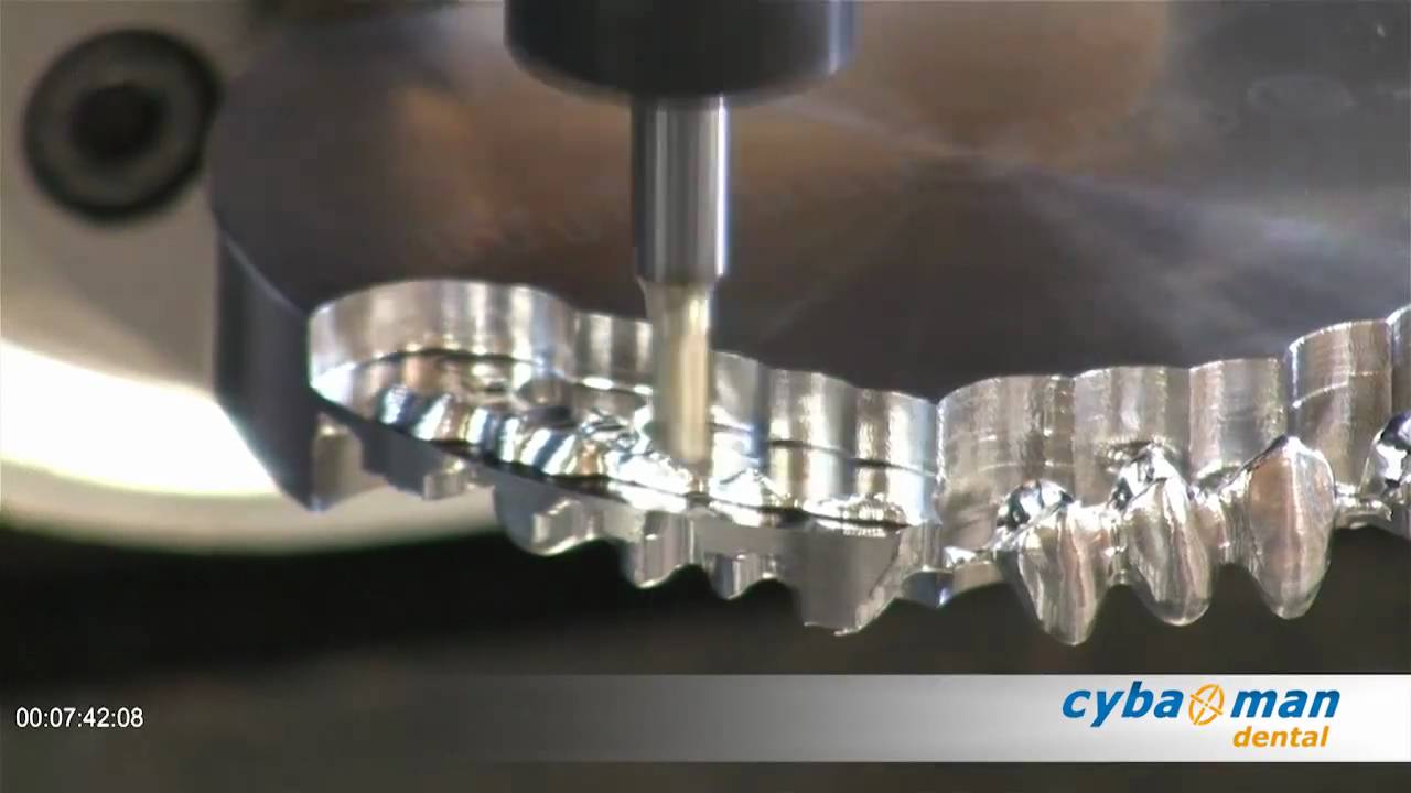 Cybaman Dental - Chrome Cobalt Bridge Machining - Roughing