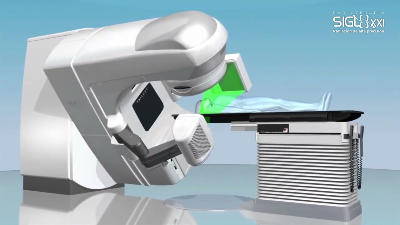 Radioterapia de Intensidad Modulada o IMRT