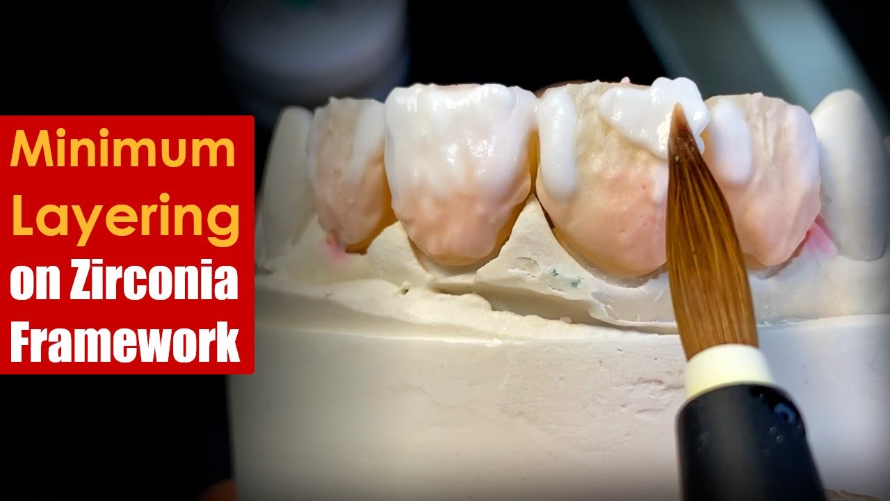 How to Apply Minimum Layering on a Zirconia Framework