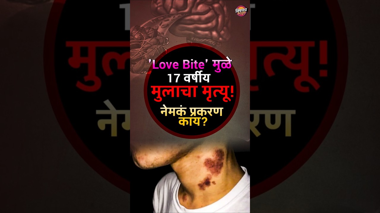Viral News : 'Love Bite' मुळे 17 वर्षीयमुलाचा मृत्यू! नेमकं प्रकरण काय ? | Vishaych Bhari
