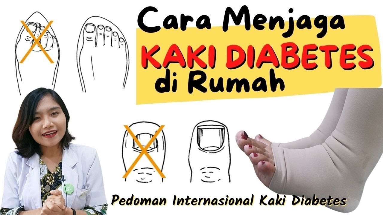 CARA JAGA KAKI DIABETES  | dr.Emasuperr