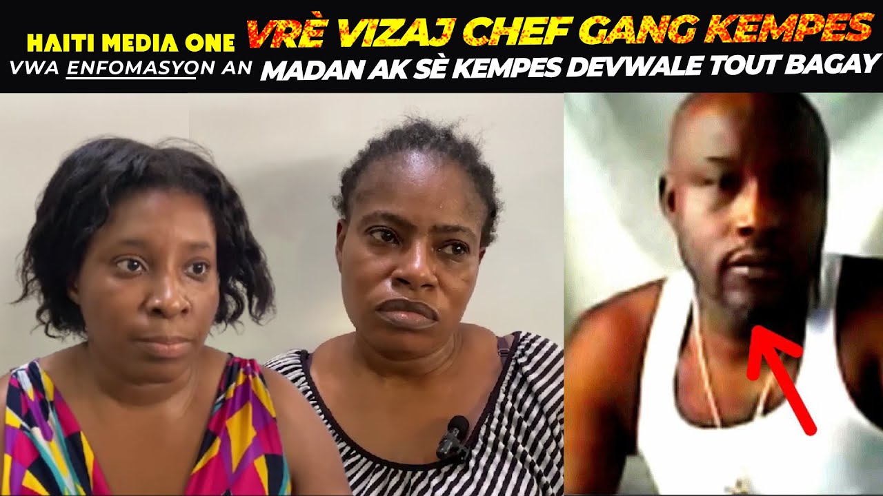 Madan Ak Sè Kempes La Depale Bay DCPJ Vrè Figi kempes Nan Lari