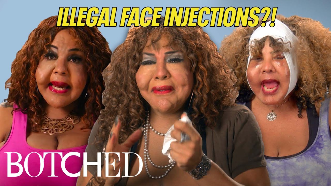 Rajee Had Cement and Concrete Injected Into Her Face?! | Botched | E!