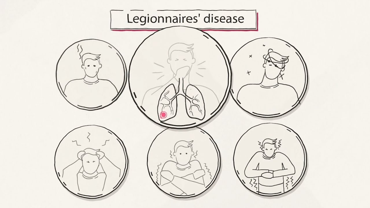 Legionella and water hygiene in healthcare in the U.S. - what you need to know