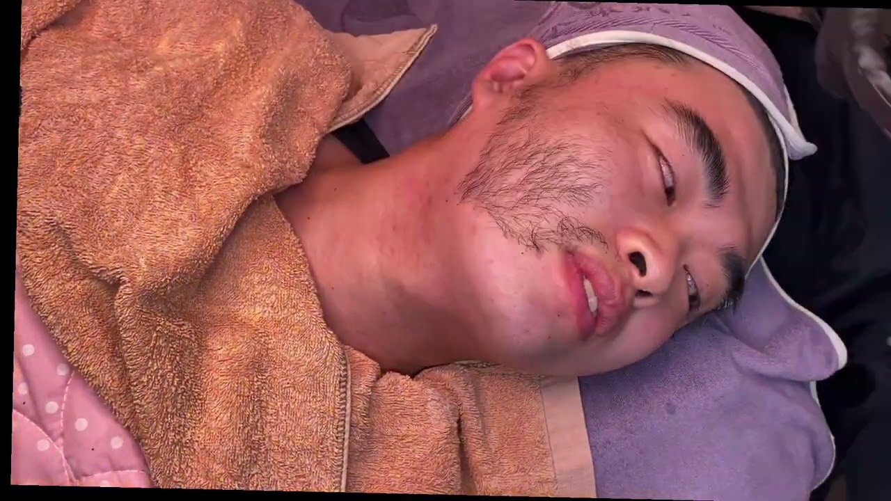 男生臉部 熱蠟脫毛  手法影片