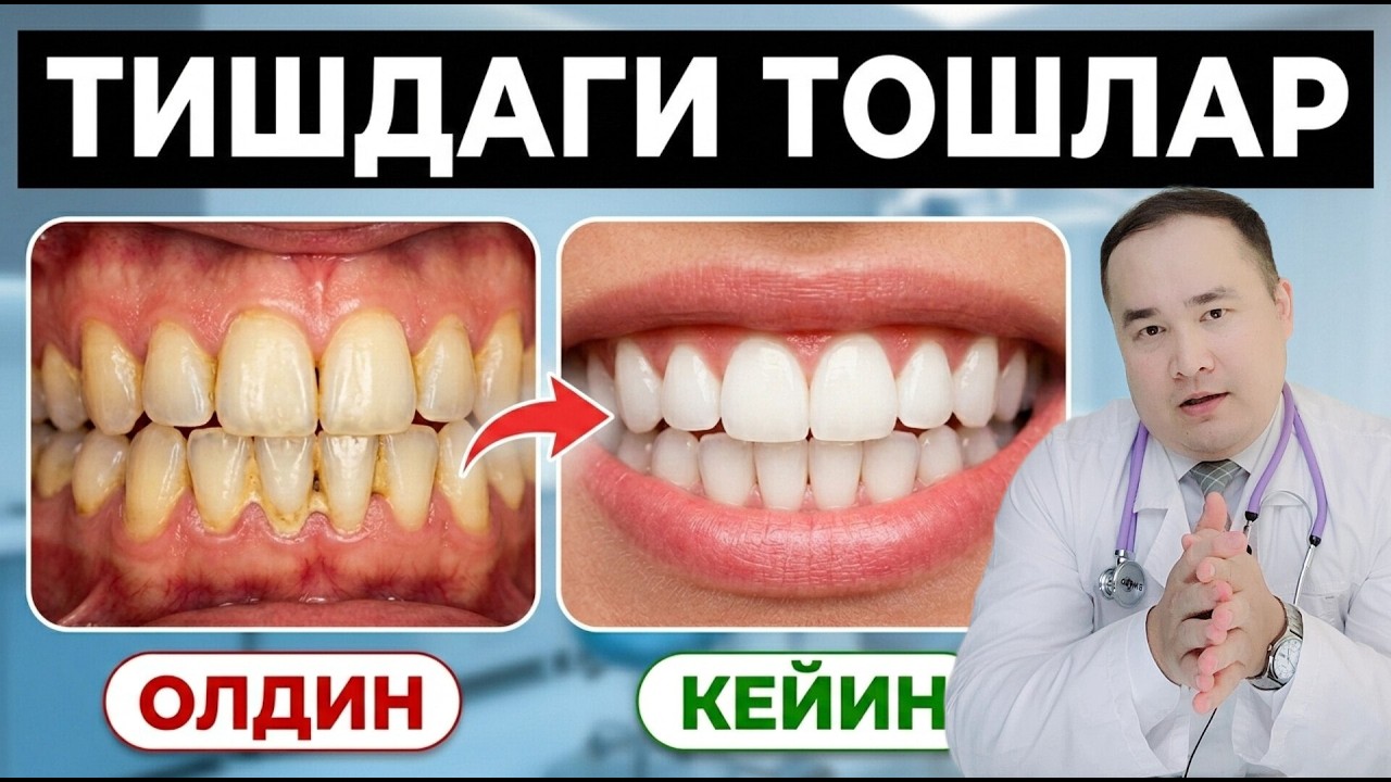 ТИШДАГИ ТОШЛАР НЕГА ХАВФЛИ ВА УЛАРНИ ТОЗАЛАТИШИНИ ФОЙДАЛАРИ НИМАЛАР, КАМЧИЛИКЛАРИ-ЧИ ШУ ҲАҚИДА