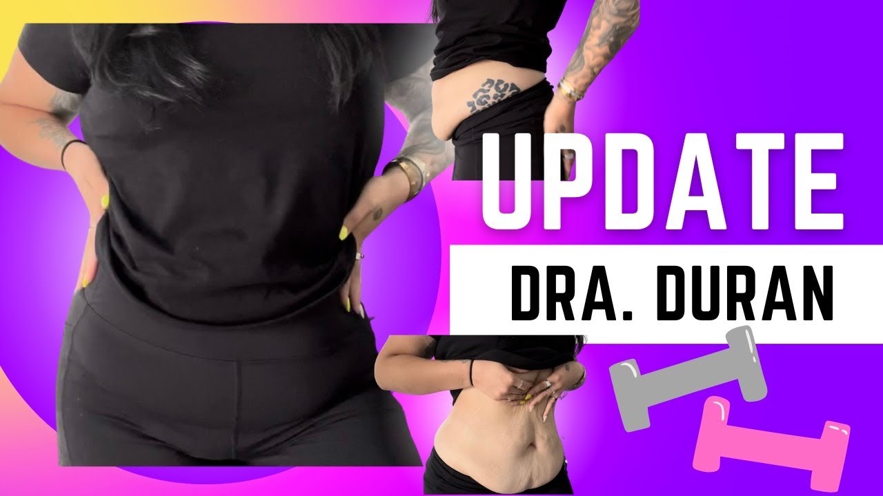 NEW SURGERY DATE WITH DRA DURAN & PRE OP BODY | Plastic Surgery in Dominican Republic