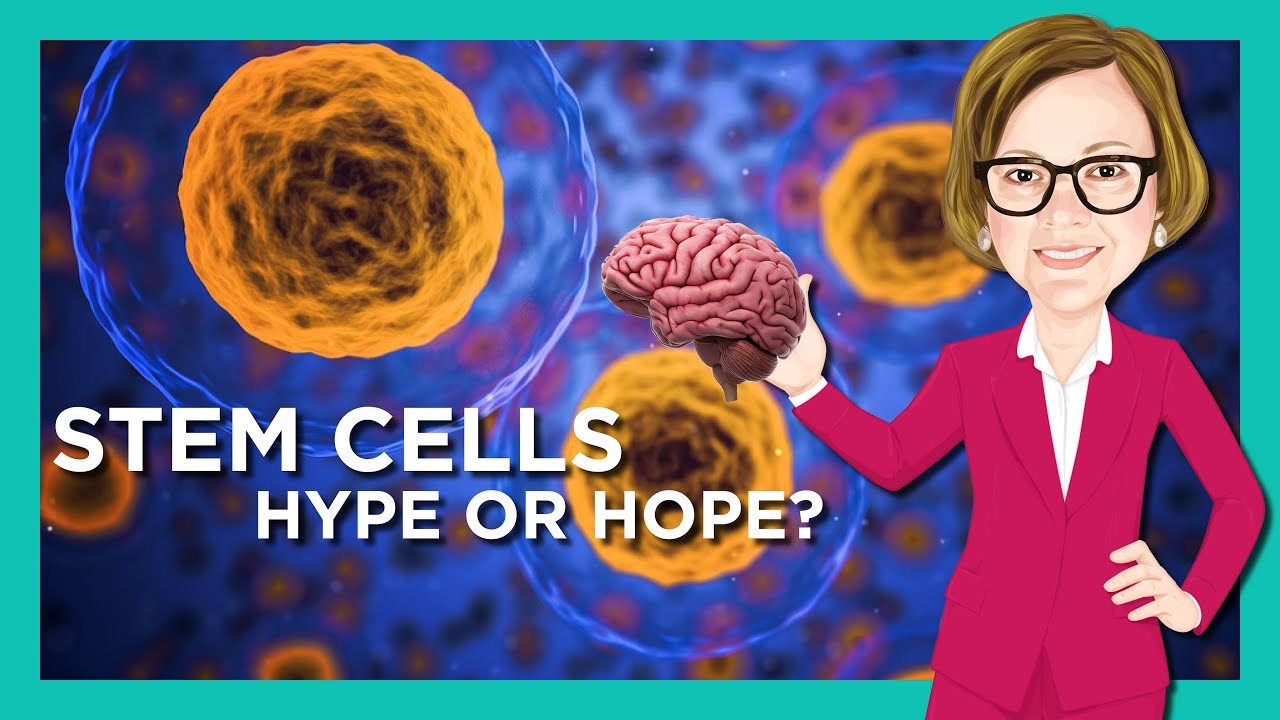 Stem Cell Therapy in Stroke: Hype or Hope?