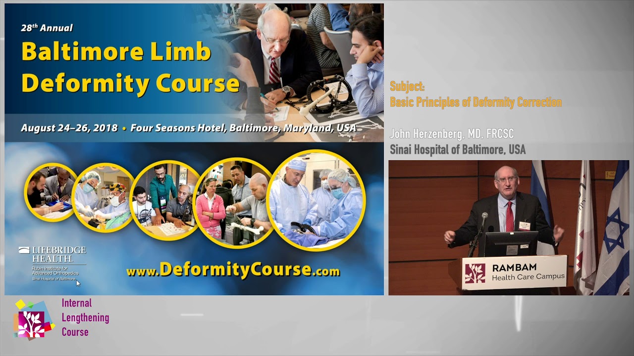 2 Basic Principles of Deformity Correction - John Herzenberg MD. FRCSC