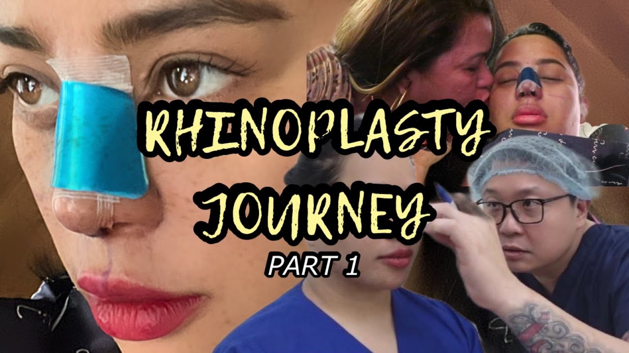 My Rhinoplasty Journey Pt.1 | DOC YAPPY & THE ICON CLINIC