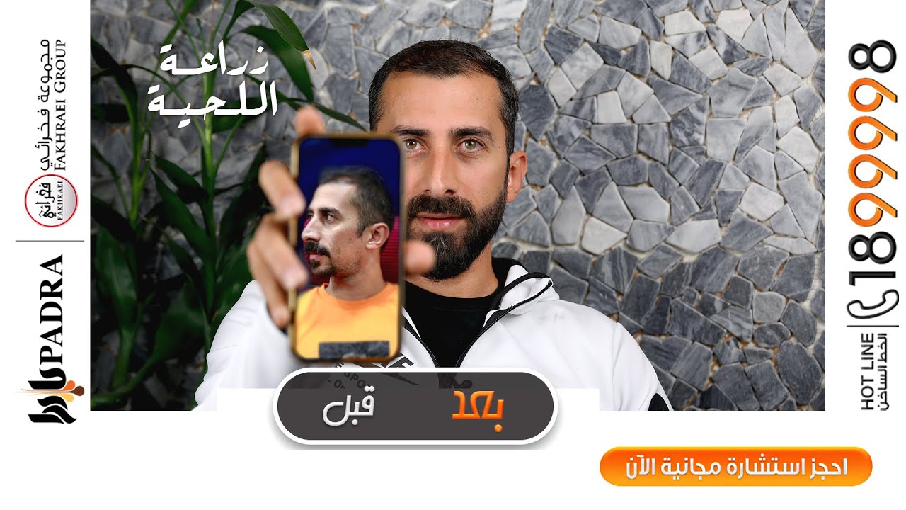 فيديو للعميل عبدالله يوضح مراحل التغير قبل زراعة اللحية وبعد الزراعة اللحية في #بادرا_كلينك_الكويت