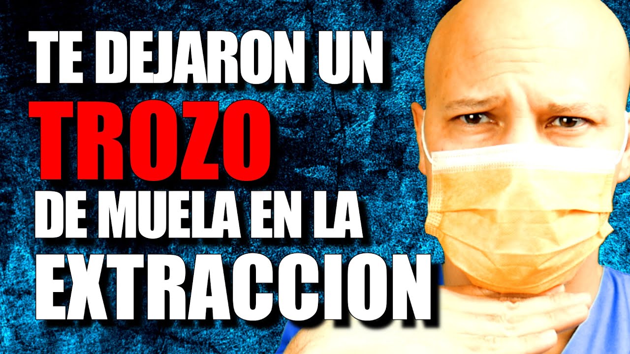 EXTRACCIÓN DENTAL, que 🅽🅾 queden RESTOS👈