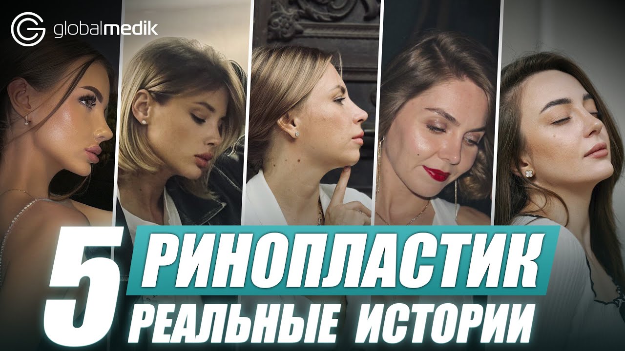 Реабилитация ринопластика! Вся правда про процесс восстановления