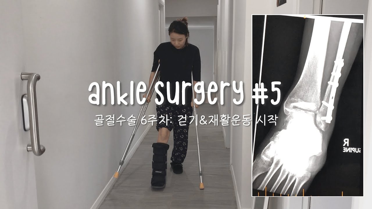 발목골절수술 6주차 걷기연습 & 재활운동 시작 관절이가 넘아푸당,,,
