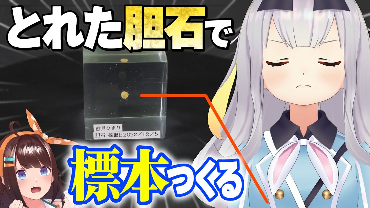 自分から採れた胆石を、レジンで固めて永遠にする…【餅月ひまり×図月つくる】