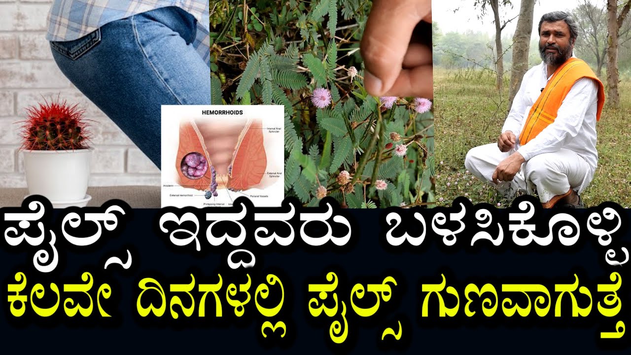 ಮುಟ್ಟಿದರೆ ಮುನಿ ಸೊಪ್ಪು | ಪೈಲ್ಸ್ ಇದ್ದವರು ಬಳಸಿಕೊಳ್ಳಿ | ಪೈಲ್ಸ್ ವಾಸಿಯಾಗುತ್ತೆ