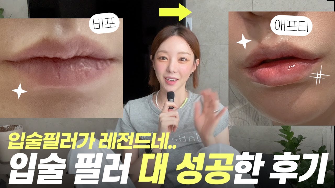 입술필러가 너무 잘되어 벅차올라 올리는 영상✨ 비용, 통증, 부작용, 잘하는 병원 찾는법 등등
