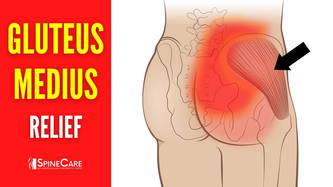 How to INSTANTLY Relieve Gluteus Medius Pain