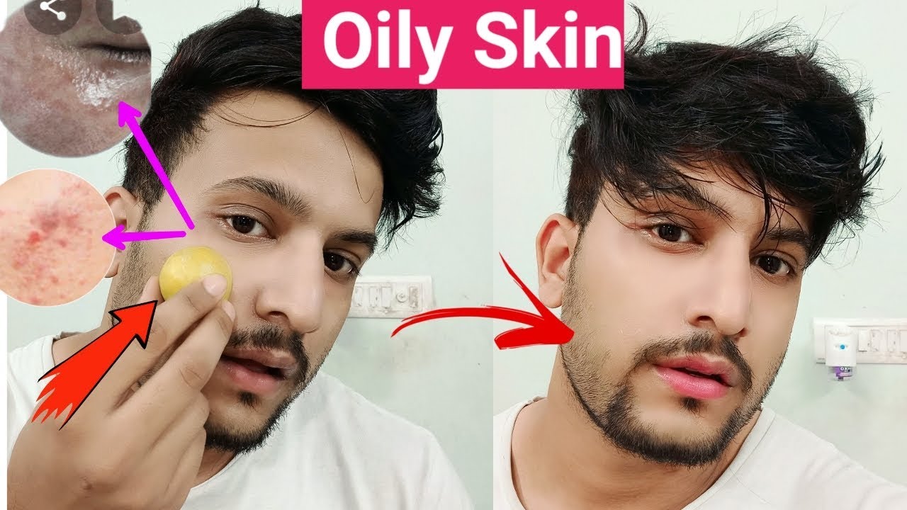 How To Control Oily Skin for Men|Hindi|How to get rid of Oily Skin[ऑयली स्किन से छुटकारा]