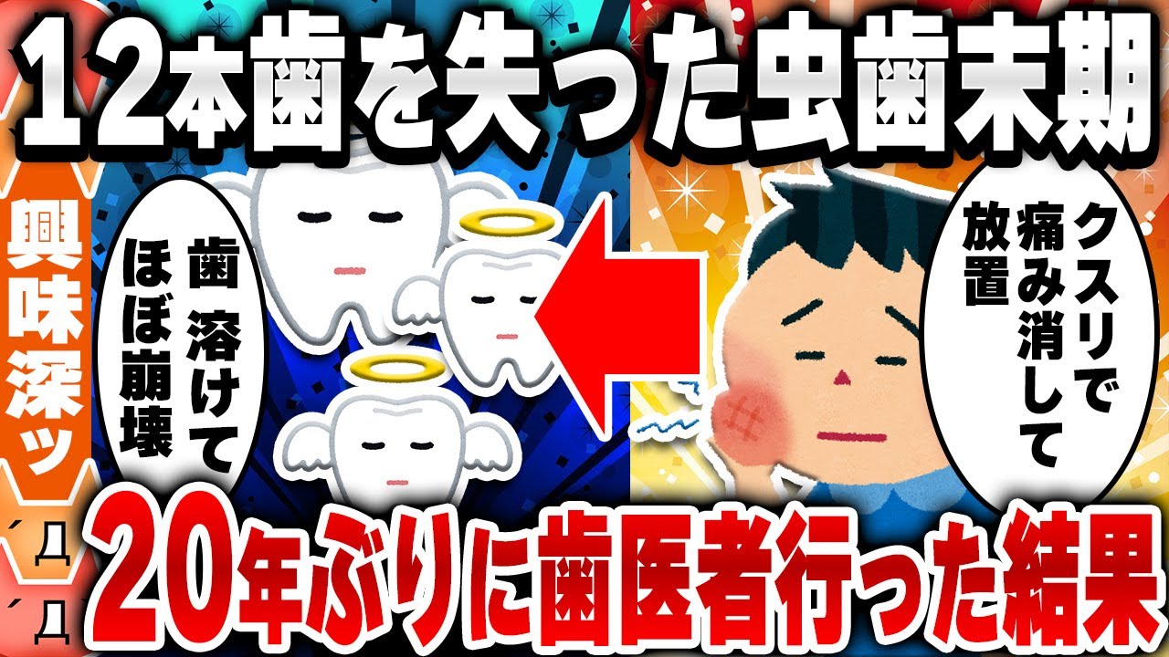 【2ch身体の雑学スレ】20年放置したエグすぎる末期虫歯を最新医療で治した結果 [ ゆっくり解説 ]