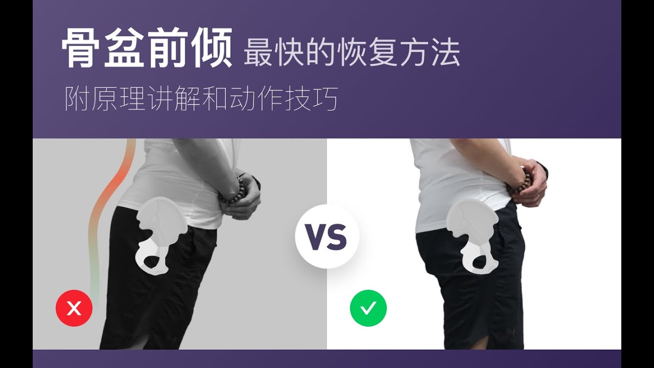 骨盆前倾的最快恢复技术