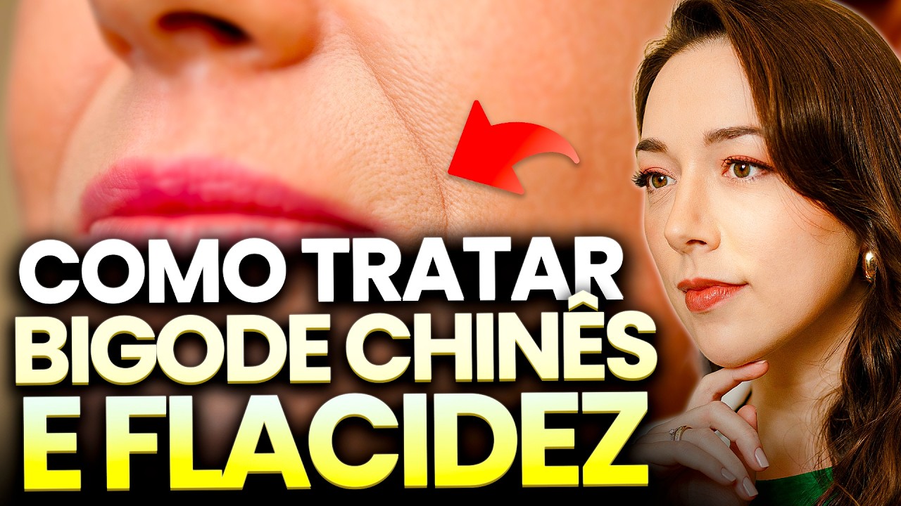 Como Tratar Bigode Chin&ecirc;s e Flacidez!