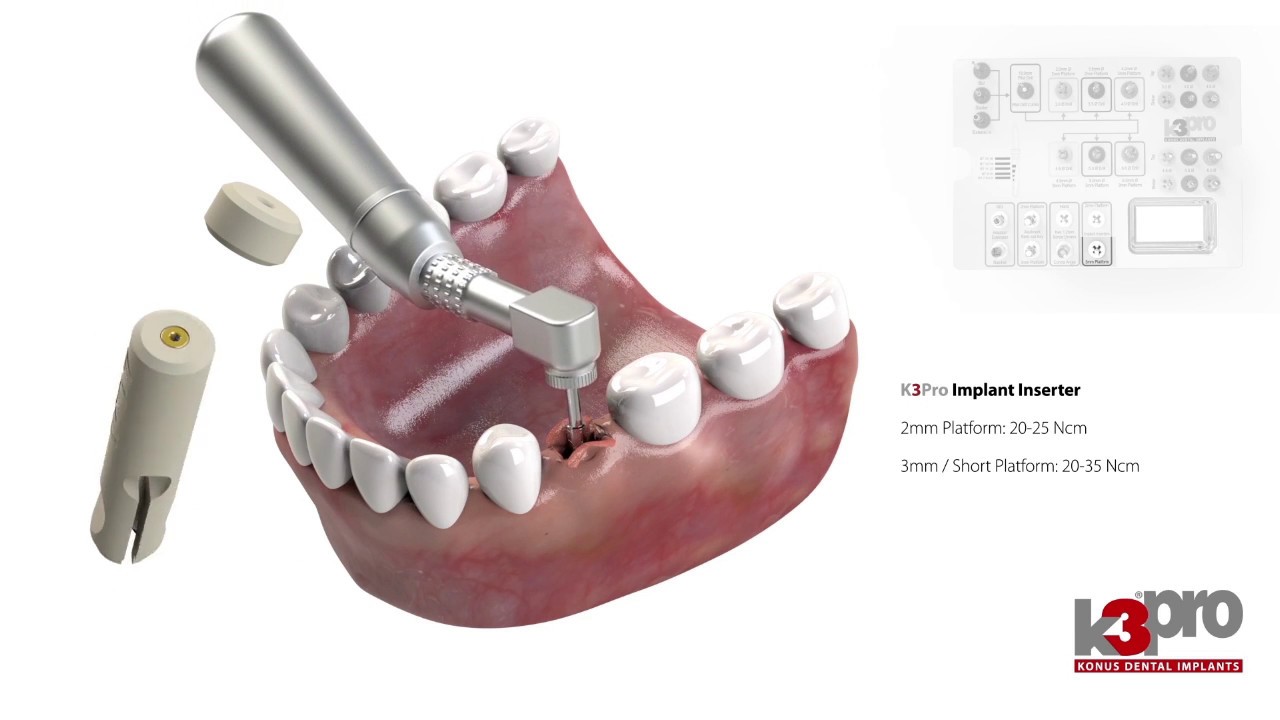 K3Pro Rapid Surgical Kit Overview