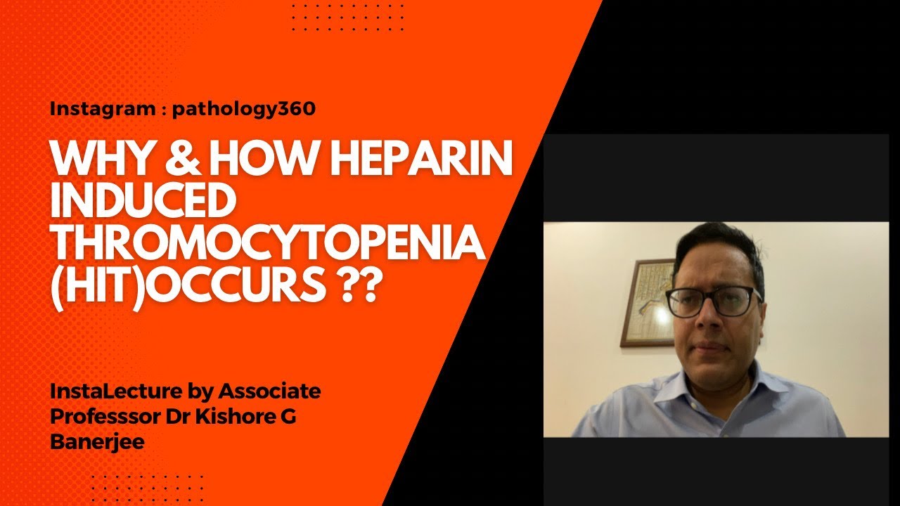 Why & how heparin induced thrombocytopenia ( HIT) occurs? The real concept of HIT simplified.