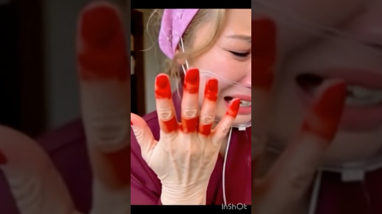 Mochi Accident Hit Hand #mochi #japan #viral