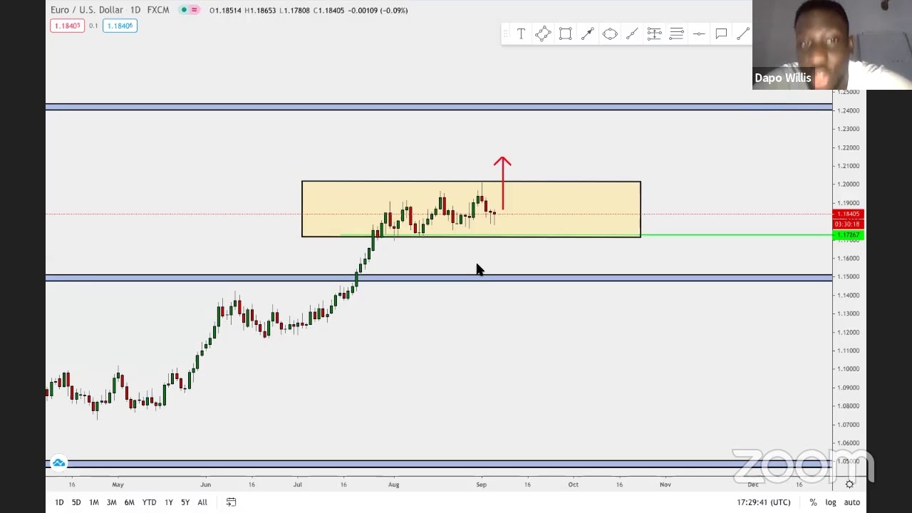 5 THINGS TO LOOK FOR BEFORE PLACING A TRADE