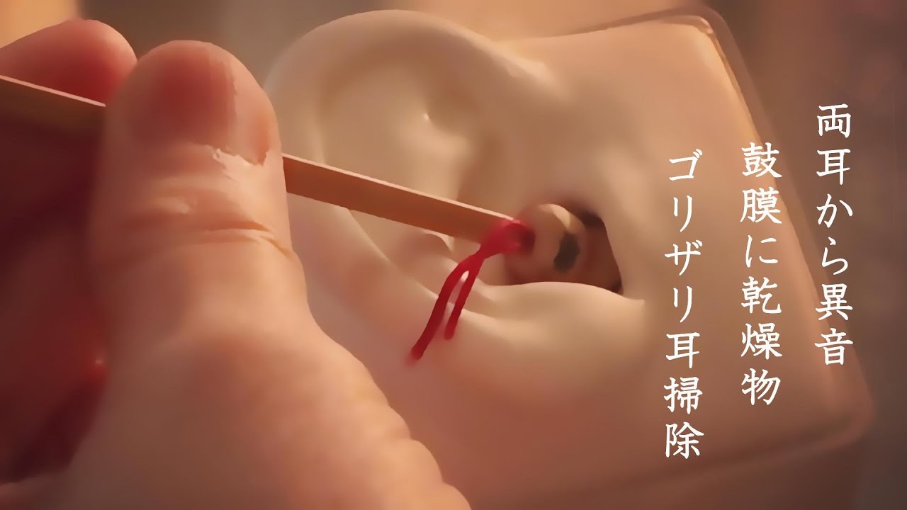 ASMR 【SR3D】両耳から異音 鼓膜にガッサガサ耳垢ゆっくりとごっりごりに耳掃除 Noise from both ears/Q-tip
