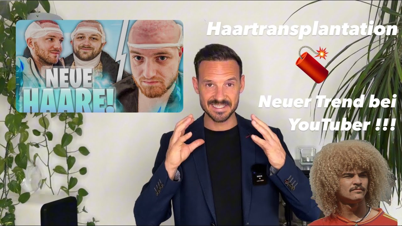 Haartransplantation gefährlicher Hype oder neuer Trend 📈 ?