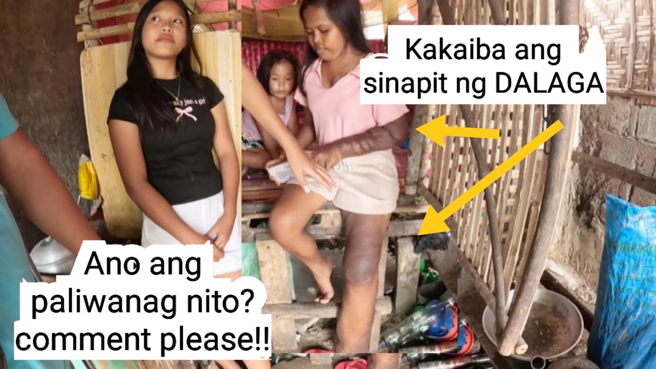 ANG LAKI AT MAITIM ang PAA at BRASO ng DALAGA ll Rene OC