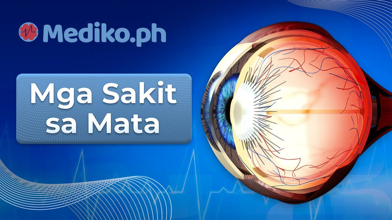Mga Sakit Sa Mata