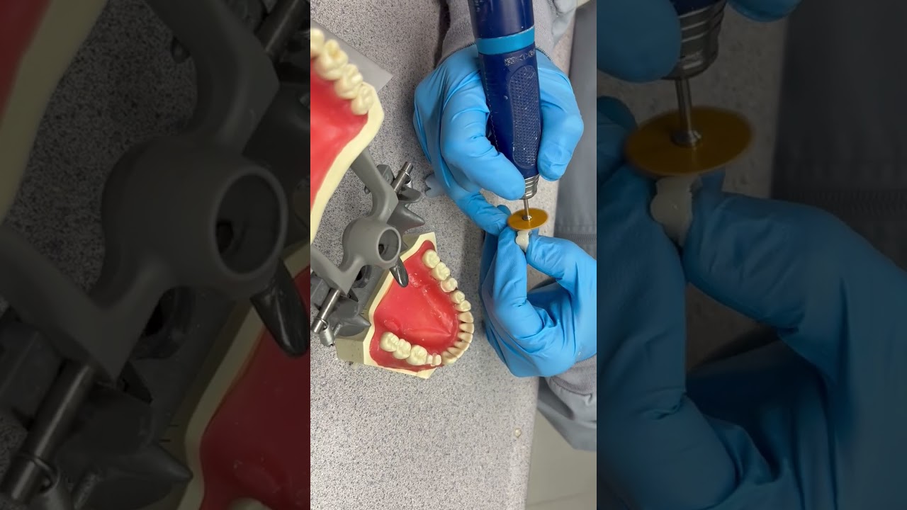 Making a provisional crown