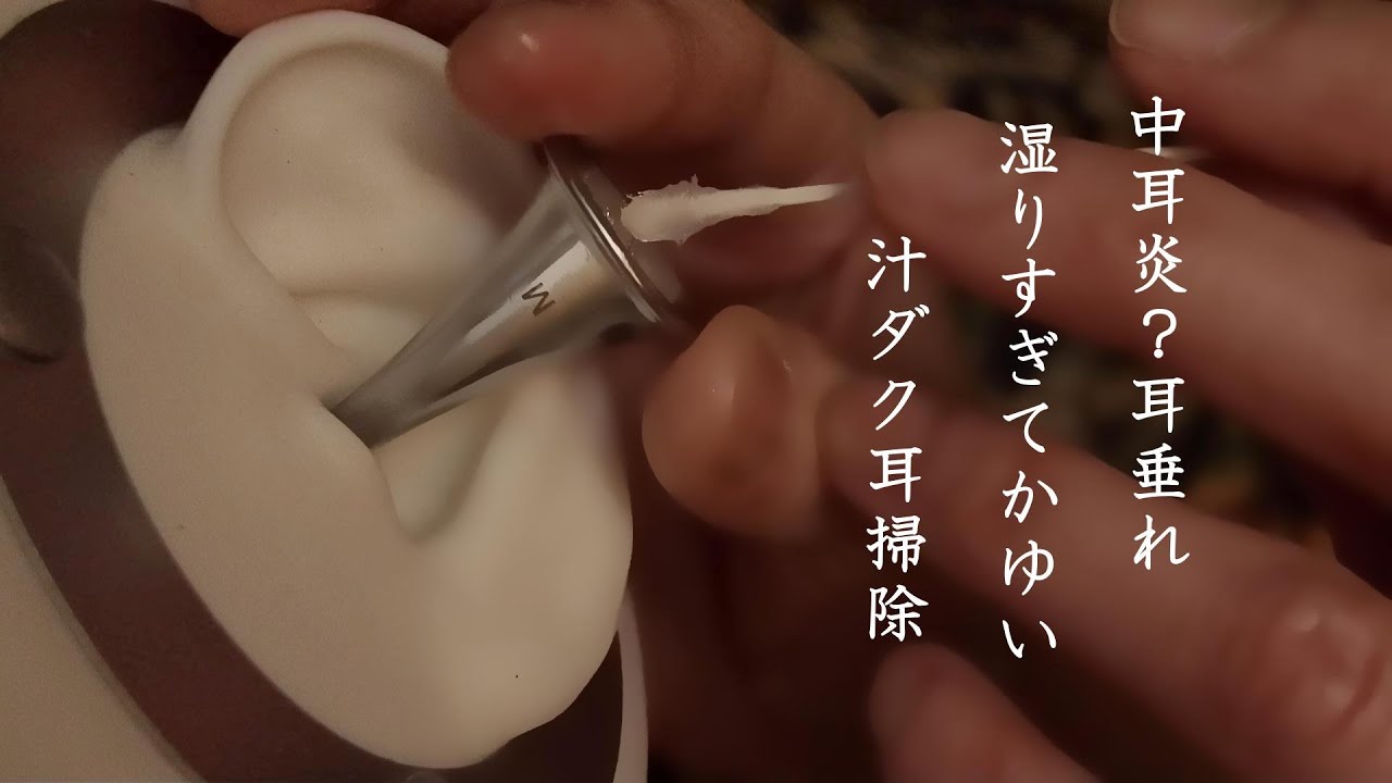 ASMR 鼓膜炎?急性中耳炎!?耳垂れ(湿り)すぎてかゆい？汁ダクを綿棒でこすり取るような耳掃除・竹耳かきすりすりQ-tips earpick Wet ear cleaning