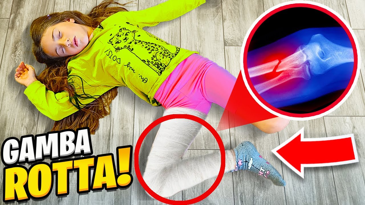 GIADA CADE E SI FA MALE E SI ROMPE LA GAMBA MENTRE GIOCA A NASCONDINO CON MAMMA E RIKY!
