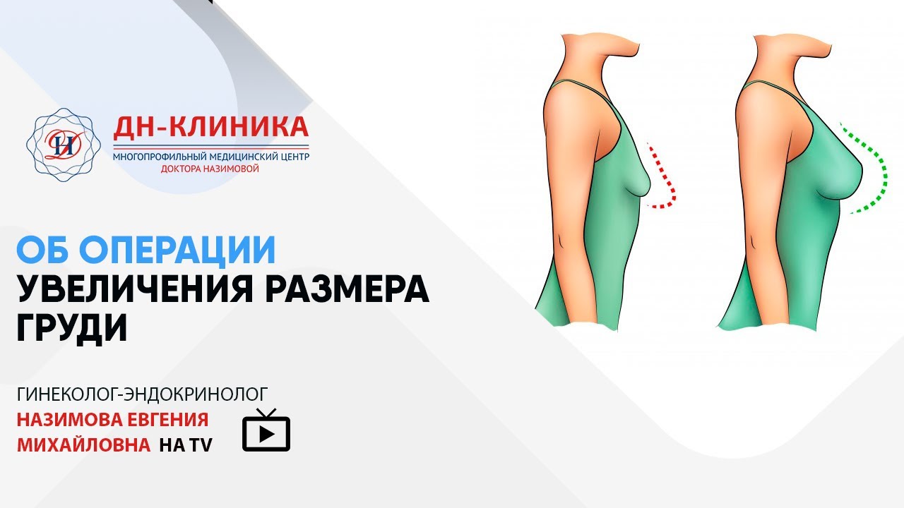 Об операции увеличения размера груди. Доктор Назимова