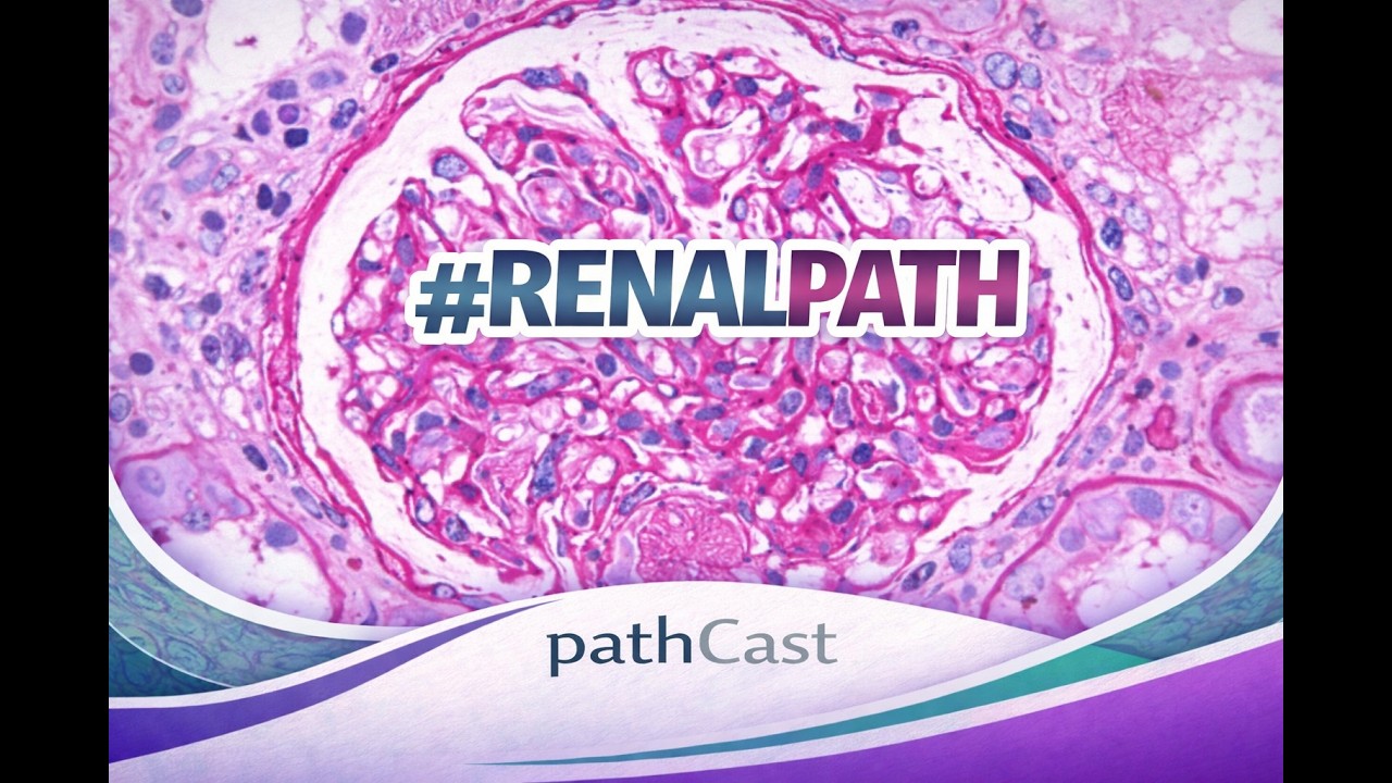 #PATHBOARDS  Basic Kidney Pathology for Pathology Boards - Part 1