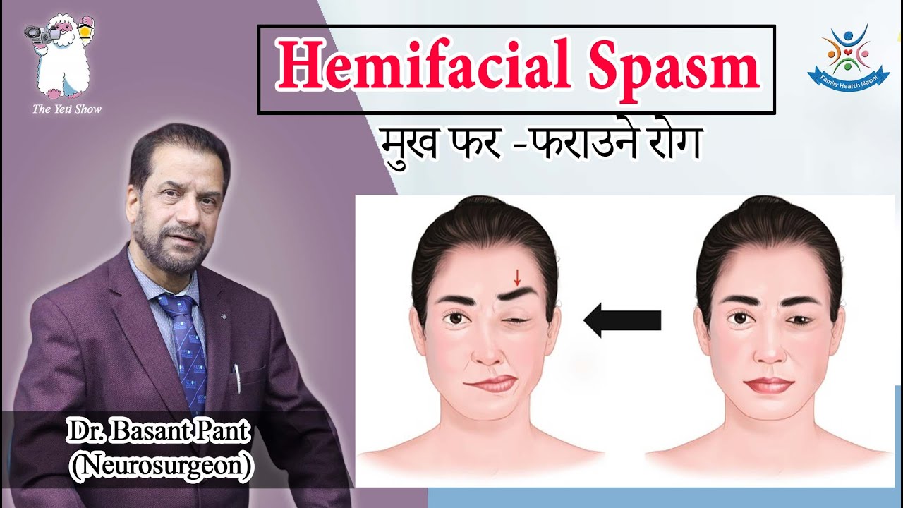 Episode:85 Hemifacial Spasm ( मुख फर -फराउने रोग) Dr. Basant Pant (Annapurna Neuro Hospital)