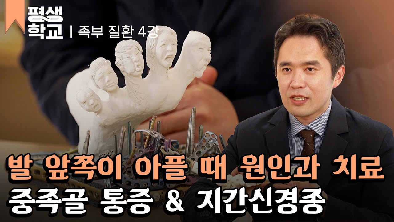 [#EBS평생학교] 4강 중족골 통증과 지간신경종│김형년의 친절한 주치의 - 족부 질환