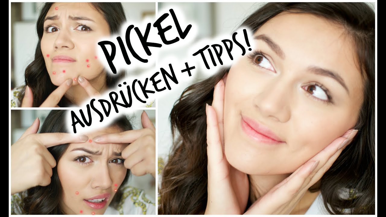 PICKEL RICHTIG AUSDRÜCKEN + Tipps! #BetterSkinwithAnna