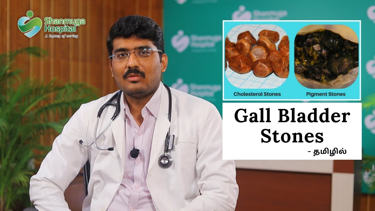 Gallbladder Stones - Symptoms and Treatment | Advice from Dr Magudeeshwaran | Shanmuga Hospital