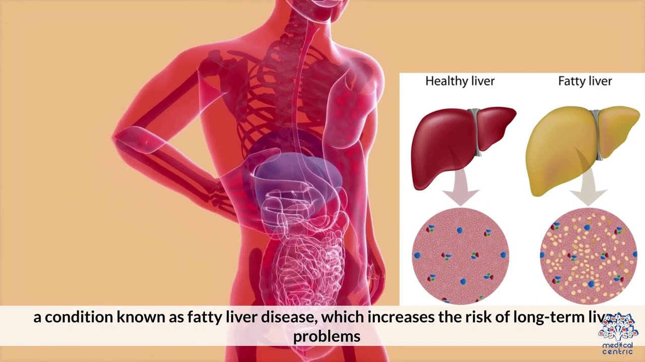 Binge Drinking: What Really Happens to Your Body