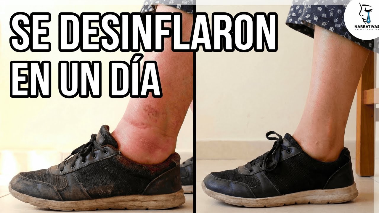 Mis TOBILLOS se deshincharon en 24h con esta agua 